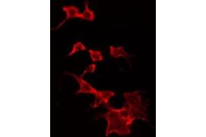 ABIN6268960 staining Hela by IF/ICC. (Stathmin 1 anticorps  (N-Term))
