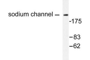 Image no. 1 for anti-Na+ Channel Protein antibody (ABIN271819) (Na+ Channel Protein anticorps)