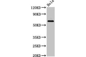 Western Blot Positive WB detected in: Hela whole cell lysate All lanes: SLC22A25 antibody at 6.