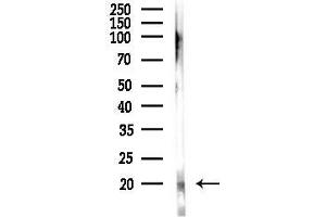 anti-Tumor Necrosis Factor, alpha-Induced Protein 8-Like 1 (TNFAIP8L1) (Internal Region) antibody
