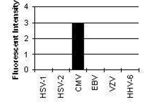 Cross Reactivity Results determined by IFA (ICP22 Delayed Early Protein (CMV ICP22) anticorps)
