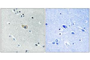 NMDAR1 (Phospho-Ser890) antibody reacts with epitope-specific phosphopeptide and corresponding non-phosphopeptide. (GRIN1/NMDAR1 anticorps  (pSer890))