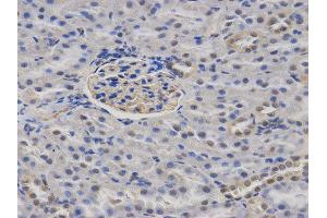 Immunohistochemistry (IHC) image for anti-Calcium/calmodulin-Dependent serine Protein Kinase (MAGUK Family) (CASK) antibody (ABIN1871447) (CASK anticorps)