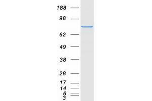 Validation with Western Blot