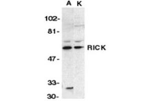 Image no. 1 for anti-Receptor-Interacting Serine-threonine Kinase 2 (RIPK2) (N-Term) antibody (ABIN318972) (RIPK2 anticorps  (N-Term))