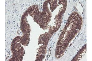 Image no. 2 for anti-CNDP Dipeptidase 2 (Metallopeptidase M20 Family) (CNDP2) antibody (ABIN1497548) (CNDP2 anticorps)
