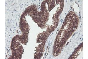 Image no. 2 for anti-CNDP Dipeptidase 2 (Metallopeptidase M20 Family) (CNDP2) antibody (ABIN1497548) (CNDP2 anticorps)
