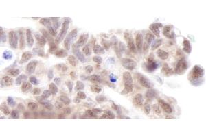 Immunohistochemistry (IHC) image for anti-Protein AF-9 (MLLT3) (AA 250-300) antibody (ABIN7448404)