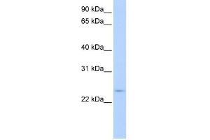 CIP29 antibody used at 0. (SARNP anticorps  (C-Term))