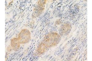 anti-Relaxin 3 (RLN3) (C-Term) antibody