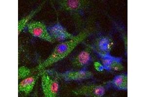 SY5Y cells stained for endogenous PARK8 (green), phosphorylated Tau (red), and DAPI nuclear staining.