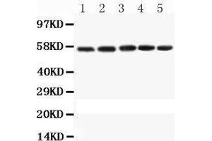 Western Blotting (WB) image for anti-Caspase 8 (CASP8) (AA 388-480) antibody (ABIN3042601) (Caspase 8 anticorps  (AA 388-480))