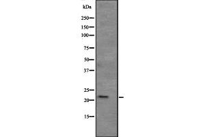 Western blot analysis of APR3 expression in human kidney tissue lysate ,The lane on the left is treated with the antigen-specific peptide. (ATRAID anticorps  (Internal Region))
