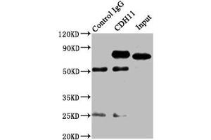 Immunoprecipitating CDH11 in SH-SY5Y whole cell lysate Lane 1: Rabbit control IgG instead of ABIN7146201 in SH-SY5Y whole cell lysate.