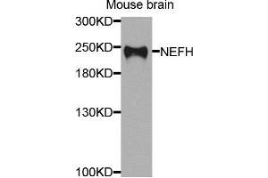 Western blot analysis of extracts of mouse brain cells, using NEFH antibody. (NEFH anticorps)