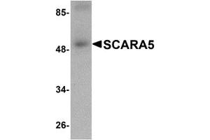 Western Blotting (WB) image for anti-Scavenger Receptor Class A, Member 5 (SCARA5) (C-Term) antibody (ABIN1030645) (SCARA5 anticorps  (C-Term))