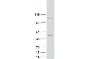 Validation with Western Blot