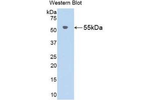 Western Blotting (WB) image for anti-Angiotensinogen (serpin Peptidase Inhibitor, Clade A, Member 8) (AGT) (AA 25-477) antibody (ABIN1857948) (AGT anticorps  (AA 25-477))