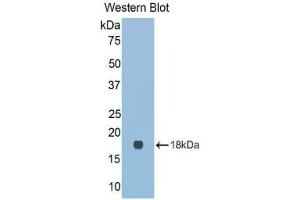 Western blot analysis of the recombinant protein. (LGALS9C anticorps  (AA 17-148))