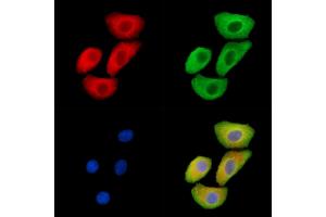 ABIN6265590 and ABIN6279872 staining Hela cells by IF/ICC.