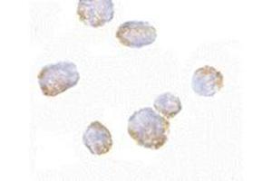 Immunocytochemistry of VPS53 in 293 cells with VPS53 antibody at 5 μg/ml.