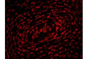 Formalin-fixed and paraffin-embedded mouse embryo labeled with Anti-HOXA10 Polyclonal Antibody, Unconjugated (ABIN723725) 1:200, overnight at 4 °C, The secondary antibody was Goat Anti-Rabbit IgG,Cy3 conjugated used at 1:200 dilution for 40 minutes at 37 °C.