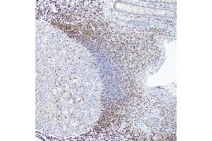 Immunohistochemistry of paraffin-embedded human appendix(100X) using Bcl-2 antibody (ABIN7265810) at dilution of 1:100 (40x lens).