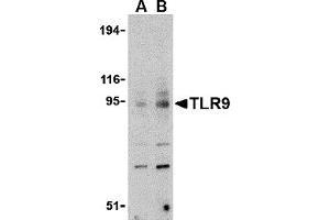 Western Blotting (WB) image for anti-Toll-Like Receptor 9 (TLR9) (C-Term) antibody (ABIN1030747) (TLR9 anticorps  (C-Term))