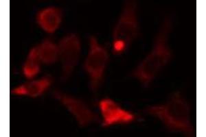ABIN6274083 staining Hela cells by IF/ICC. (PDLIM1 anticorps  (Internal Region))
