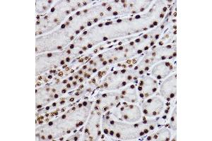 Immunohistochemistry of paraffin-embedded mouse kidney using CTBP2 Rabbit mAb (ABIN7265979) at dilution of 1:100 (40x lens). (CTBP2 anticorps)