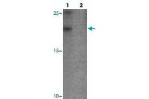 Western blot analysis of YPEL3 in A-20 cell lysate with YPEL3 polyclonal antibody  at 1 ug/mL in (lane 1) the absence and (lane 2) the presence of blocking peptide.