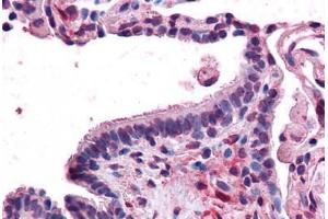 Human Lung, Respiratory Epithelium: Formalin-Fixed, Paraffin-Embedded (FFPE) (MFI2 anticorps  (N-Term))