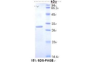 SDS-PAGE (SDS) image for Dihydrolipoyl Transacetylase (DLAT) (AA 368-626) protein (His tag) (ABIN2120968)