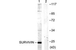 Western blot analysis of extracts from mouse lung cells, using Survivin (Ab-117) Antibody.