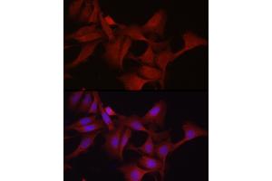 Immunofluorescence analysis of U2OS cells using GPX4 Rabbit pAb (ABIN3015729, ABIN3015730, ABIN3015731, ABIN1680090 and ABIN6219078) at dilution of 1:200 (40x lens).