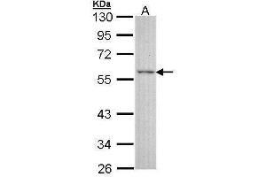 WB Image Sample (30 ug of whole cell lysate) A: A431 , 10% SDS PAGE antibody diluted at 1:3000 (ESRRG anticorps)