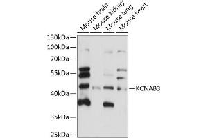 Western blot analysis of extracts of various cell lines, using KCN antibody (ABIN7269482) at 1:1000 dilution. (KCNAB3 anticorps  (AA 285-404))