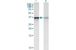 Western Blot analysis of PHC2 expression in transfected 293T cell line by PHC2 monoclonal antibody (M01), clone 1F4. (PHC2 anticorps  (AA 91-200))