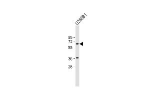 Anti-TXK Antibody (N-term) at 1:2000 dilution + U266B1 whole cell lysate Lysates/proteins at 20 μg per lane.