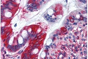Human Small Intestine (formalin-fixed, paraffin-embedded) stained with TFG antibody ABIN290224 at 10 ug/ml followed by biotinylated goat anti-rabbit IgG secondary antibody ABIN481713, alkaline phosphatase-streptavidin and chromogen. (TFG anticorps  (AA 350-400))