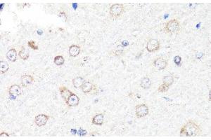Immunohistochemistry of paraffin-embedded Rat brain using RNF149 Polyclonal Antibody at dilution of 1:100 (40x lens). (RNF149 anticorps)