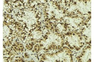 ABIN6272855 at 1/100 staining Human lung tissue by IHC-P. (CNOT1 anticorps  (Internal Region))