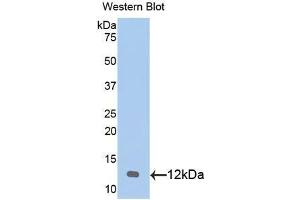 Western blot analysis of the recombinant protein. (CXCL1 anticorps  (AA 25-96))
