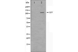Western blot analysis on 293 cell lysate using XPF Antibody. (ERCC4 anticorps  (C-Term))
