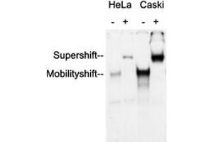 Anti-AP2 alpha/beta Antibody was used in an Electrophoretic Mobility Shift Assay (EMSA) to supershift the protein-DNA complex. (AP2 alpha/beta (C-Term) anticorps)