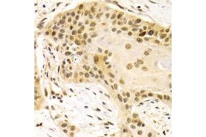 Immunohistochemistry (IHC) image for anti-Discs, Large (Drosophila) Homolog-Associated Protein 5 (DLGAP5) (AA 547-846) antibody (ABIN3023190)