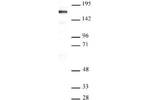 Western Blot: Nuclear extract of Saos-2 cells (20 µg per lane) probed with the SIP1 antibody (mAb) at a dilution of 1 µg/ml. (SIP1 anticorps  (AA 1-360))