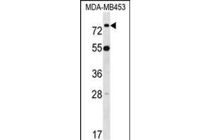 LDB3 Antibody (Center) (ABIN1538145 and ABIN2848672) western blot analysis in MDA-M cell line lysates (35 μg/lane). (LIM Domain Binding 3 Protein anticorps  (AA 235-262))