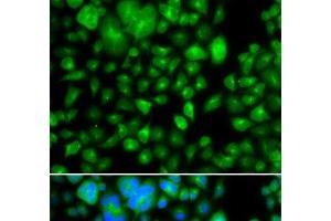 Immunofluorescence analysis of A549 cells using METTL7B Polyclonal Antibody (METTL7B anticorps)