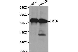 Western Blotting (WB) image for anti-Calreticulin (CALR) antibody (ABIN3021345) (Calreticulin anticorps)